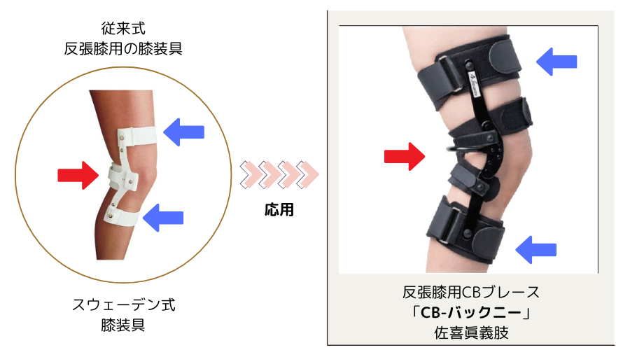 膝の痛みに対する膝サポーターの役割と選び方 | 装具ラボSTEPs